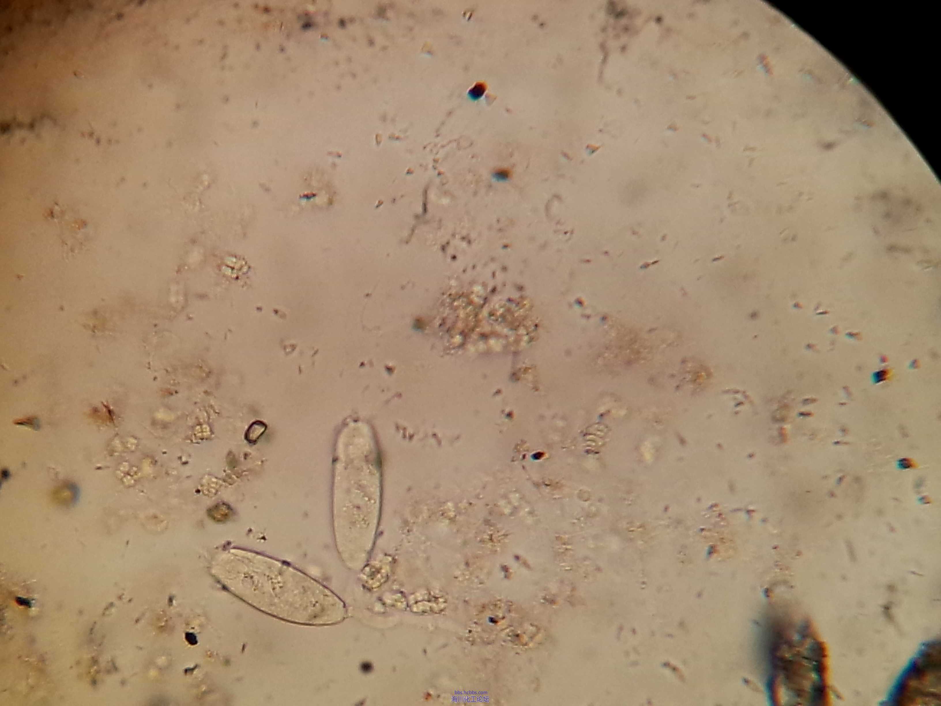 好氧池微生物镜检图片